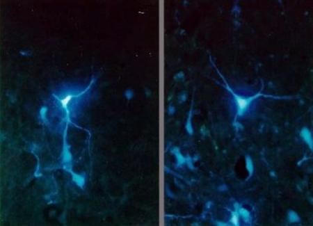 Neuroni di Substantia nigra, pars reticulata, area del tetto mesencefalico che controlla la paura e i comportamenti di difesa